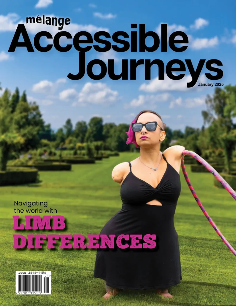 A magazine cover titled "mélange Accessible Journeys," dated January 2025. The headline reads, "Navigating the world with LIMB DIFFERENCES" in bold black and pink text. The image features a woman with limb differences confidently posing in a park. She is wearing sunglasses, a black dress, and has pink highlights in her hair, standing in a sunny green garden with a blue sky in the background. A hula hoop rests on her shoulder, emphasizing her individuality and confidence. A barcode is located in the bottom left corner.
