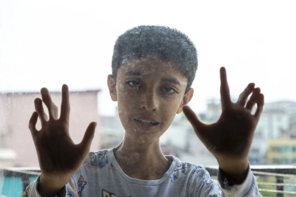 A young boy named Mohammad Hussain is seen in a close-up, head-on portrait looking through a slightly speckled glass or window pane. He presses both of his open hands against the glass, and his expression is focused. The background, which shows the faint outlines of buildings, is blurred by the glass and bright light.